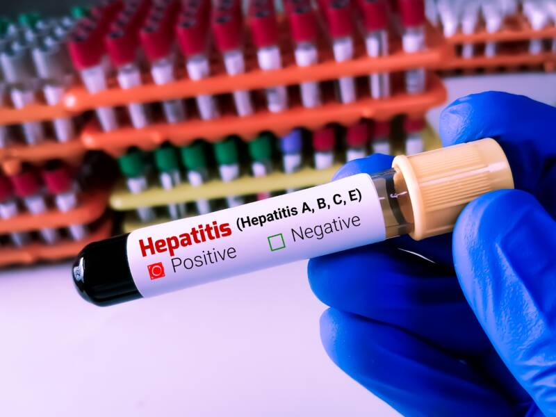 hepatitis test