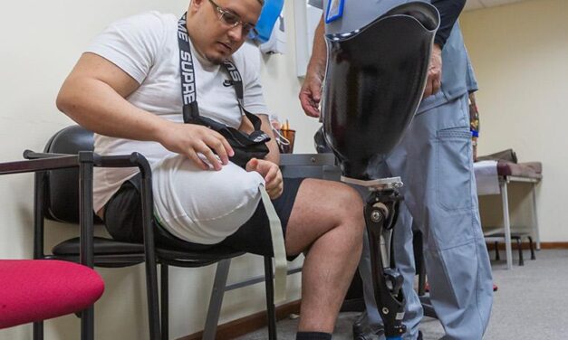 ACAA Agiliza la Entrega de Prótesis Especializadas a Lesionados como Parte de su Plan de Transformación