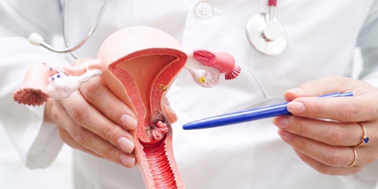 Centro Comprensivo de Cáncer invita a mujeres en Puerto Rico a participar en estudio clínico para mejorar estrategias para la prevención del cáncer cervical