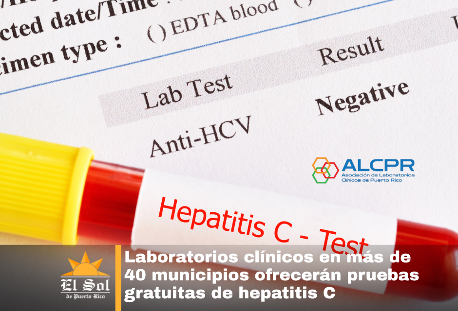Laboratorios clínicos en más de 40 municipios ofrecerán pruebas gratuitas de hepatitis C
