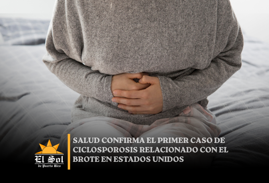 Salud confirma el primer caso de ciclosporosis relacionado con el brote en Estados Unidos