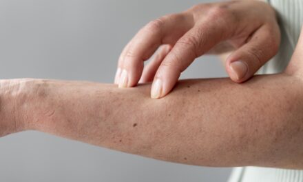 Los desencadenantes de la psoriasis en adolescentes y adultos jóvenes